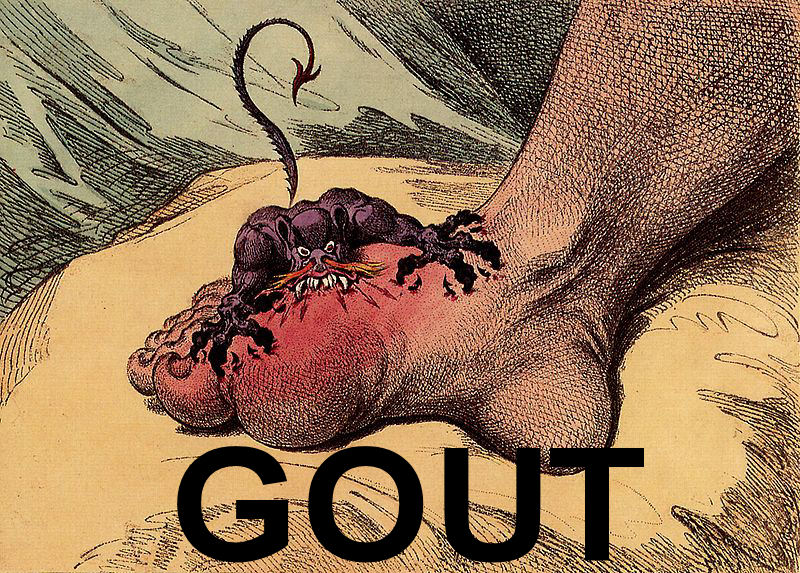 Gout